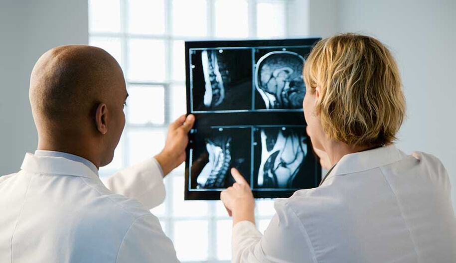diagnostic de l'ostéochondrose cervicale par imagerie