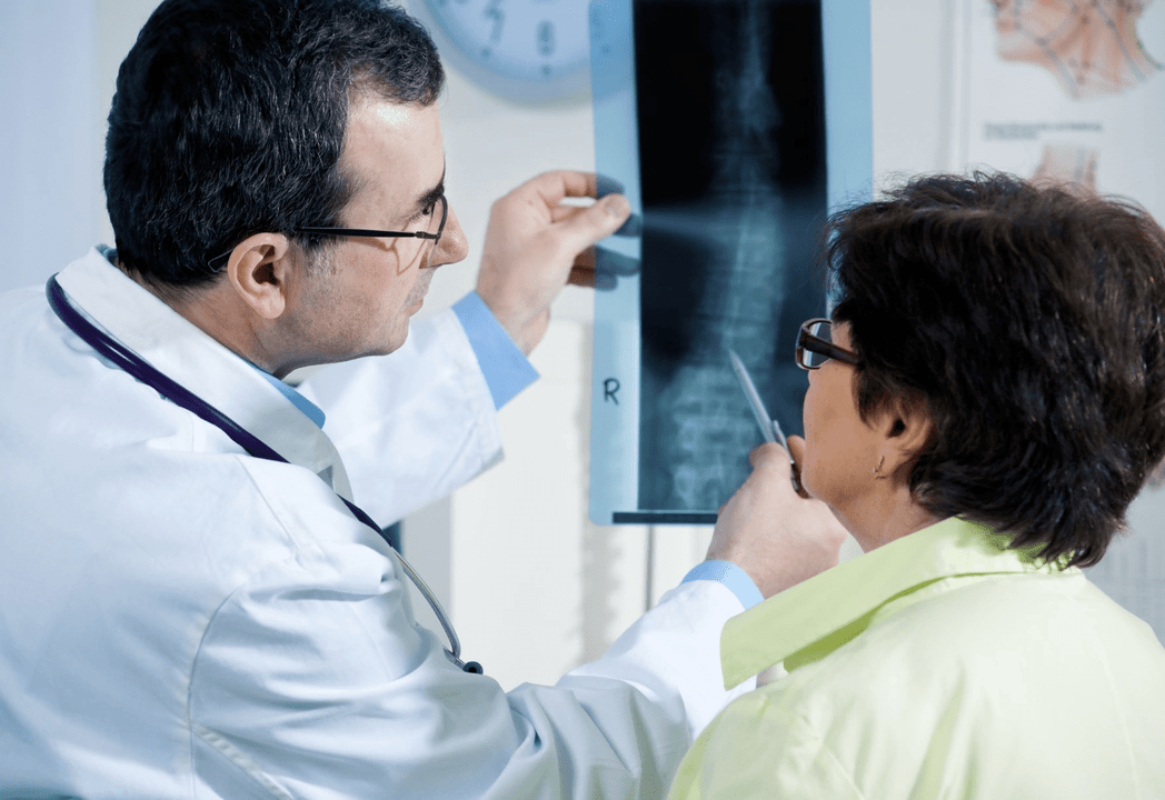 Un neurologue diagnostique l'ostéochondrose à l'aide d'une radiographie de la colonne vertébrale.